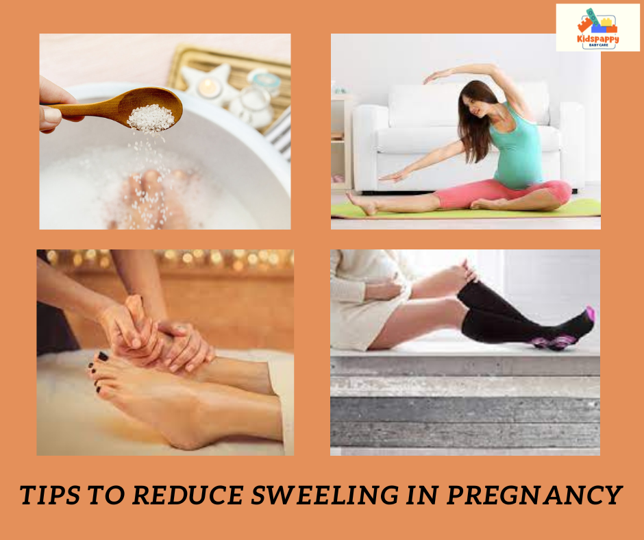 How to manage swollen legs and feet in pregnancy?