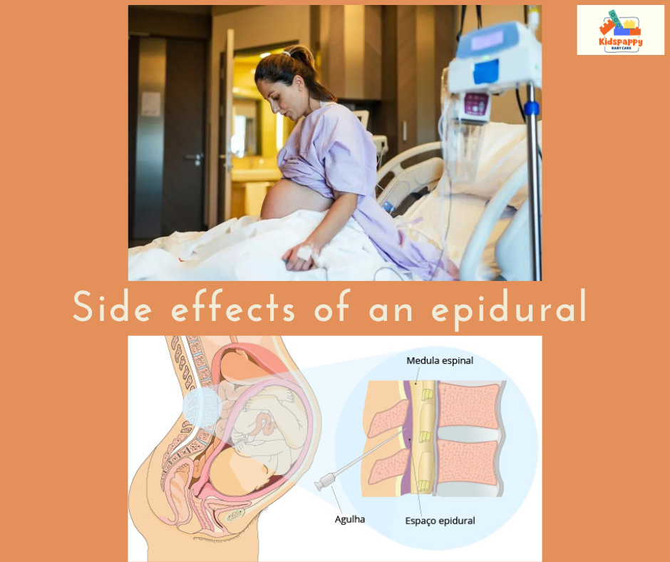 Side effects of an epidural