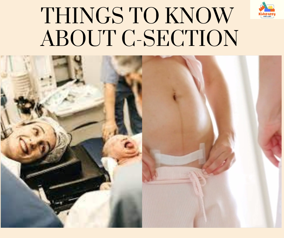 Things to know about C-section